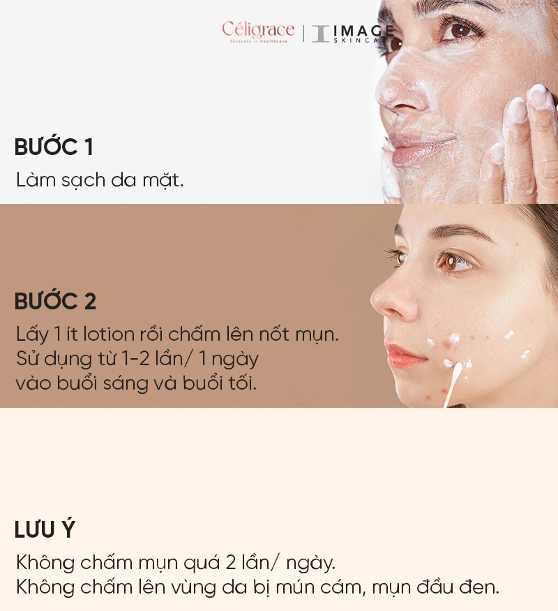 [CLESAL2401 - DATE 02/2024] Lotion IMAGE Giảm mụn, Giảm Nhờn Clear Cell Medicated Acne 50ml