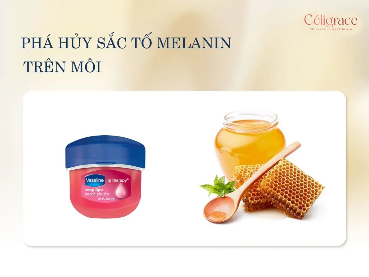 Sáp Dưỡng Môi Vaseline Cấp Ẩm, Mềm Mịn, Chống Khô Và Nứt Nẻ Lip Therapy 7g