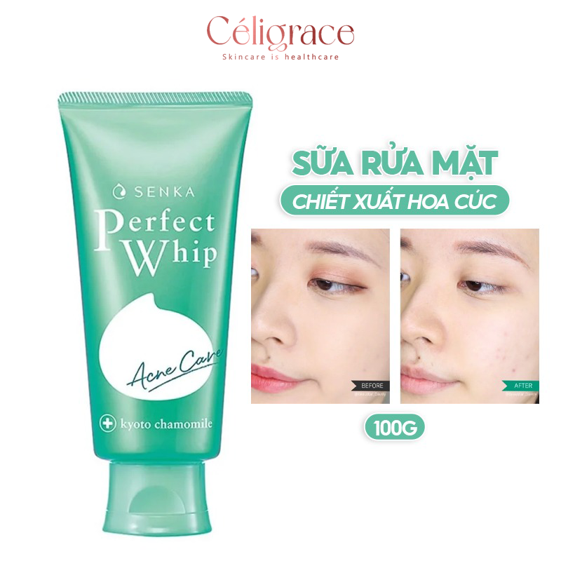 Sữa Rửa Mặt Senka Dành Cho Da Mụn Perfect Whip Acne Care