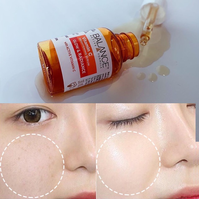 Tinh Chất  Balance Dưỡng Trắng Da Trị Thâm Active Formula Vitamin C Brightening Serum