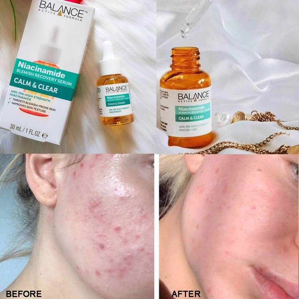 Tinh Chất Balance Active Formula Ngừa Mụn Mờ Thâm Niacinamide 15% Blemish Recovery 30ml
