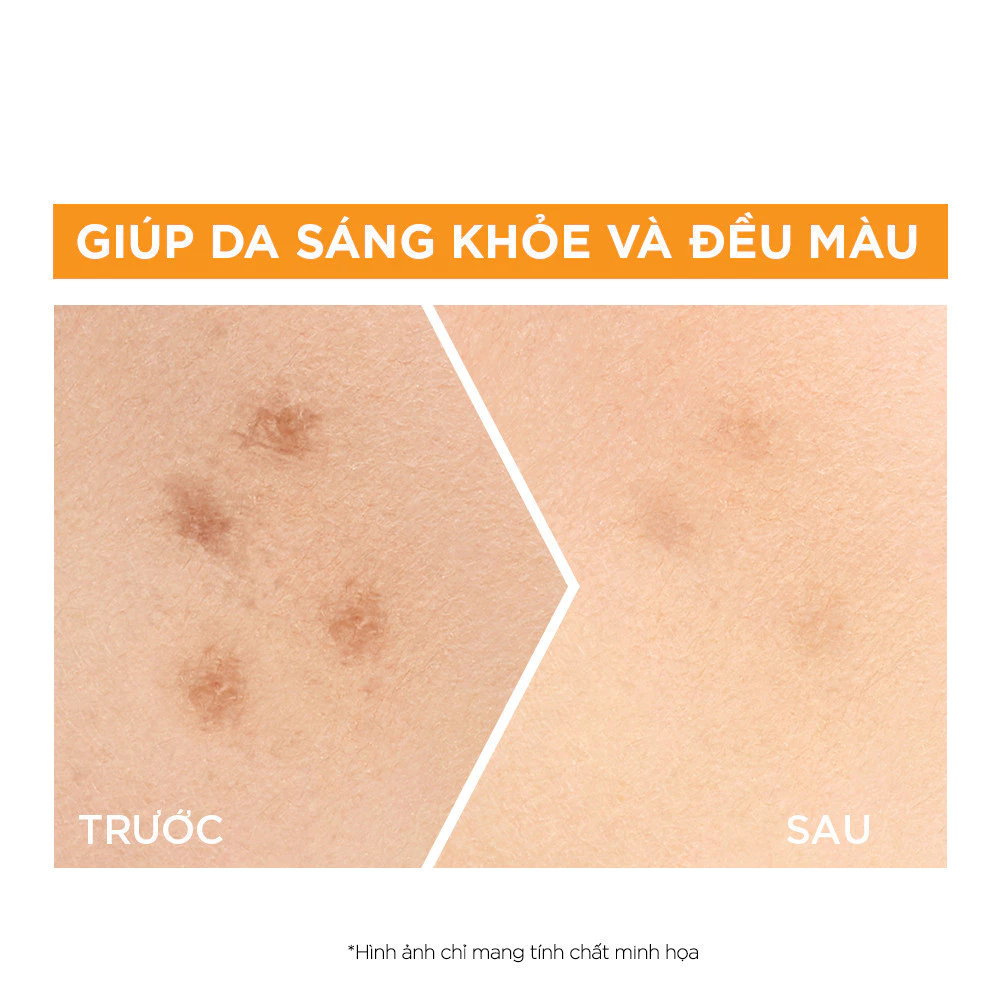 Serum Garnier Tinh Chất Tăng Cường Sáng Da Mờ Thâm GARNIER Light Complete Vitamin C 30X Booster Serum 30ml