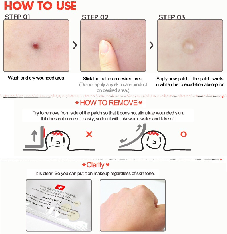 Miếng Dán Mụn Cosrx Acne Pimple Master Patch 24 Miếng (Đỏ)