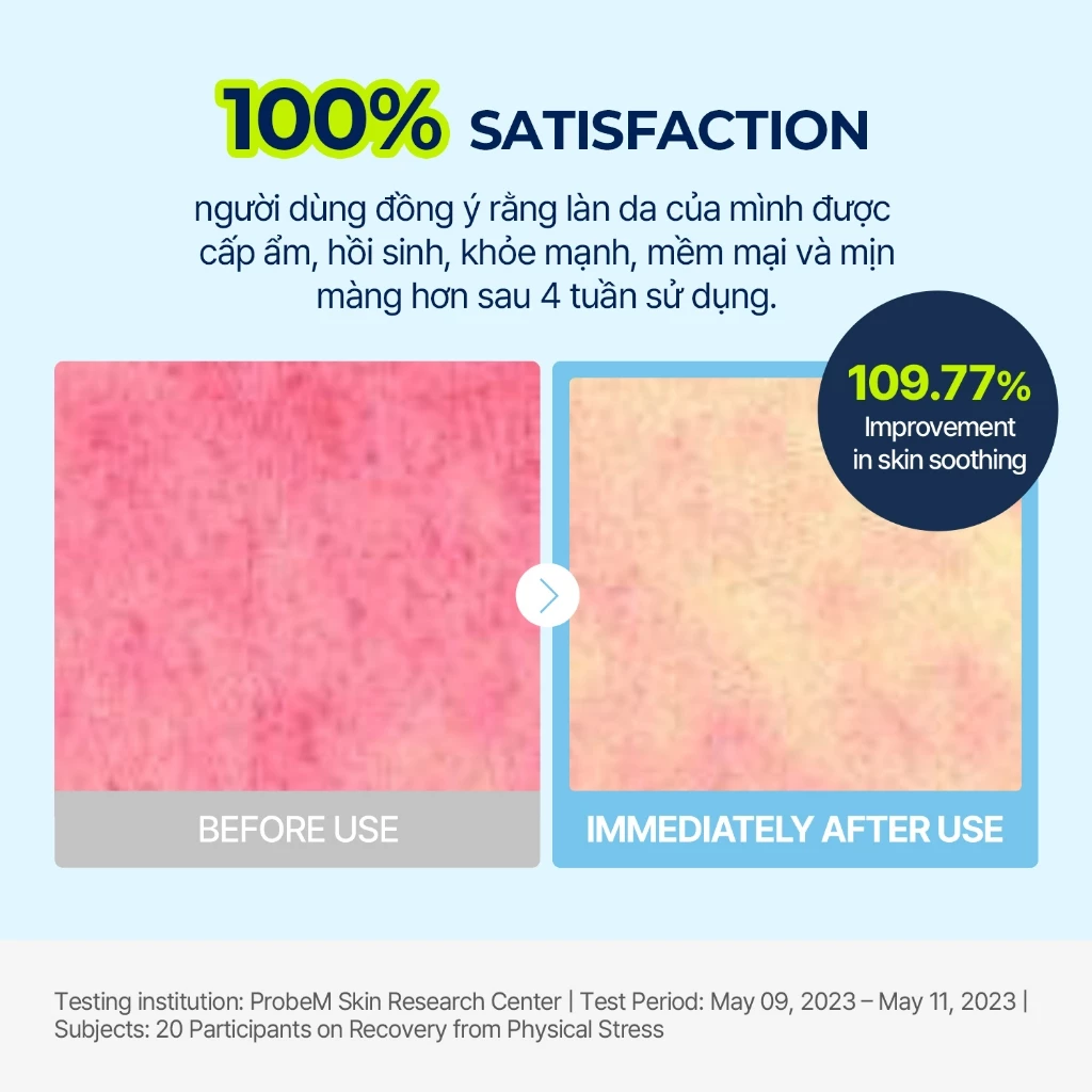 Kem Dưỡng Làm Dịu, Dưỡng Ẩm, Căng Mịn Da Torriden Dive-In Low Molecular Hyaluronic Acid Soothing Cream 100ml