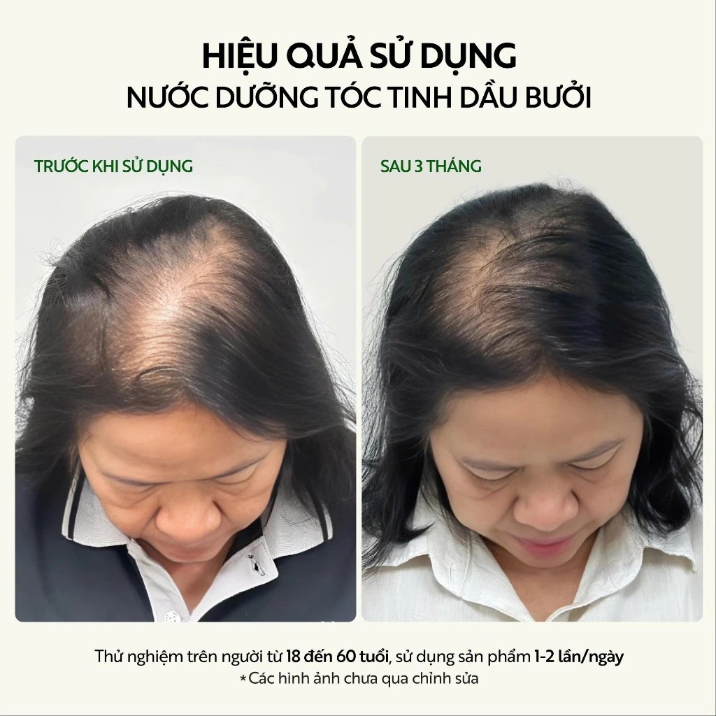 Nước Dưỡng Tóc Cocoon Tinh Dầu Bưởi Pomelo Hair Tonic 140ml