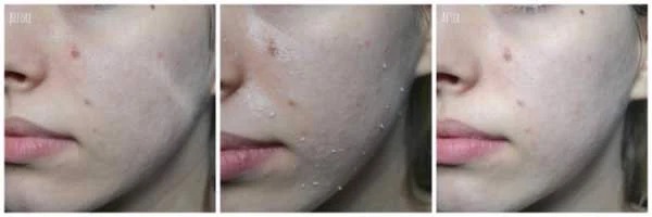 Tẩy Tế Bào Chết Mặt Rosette Chiết Xuất Từ Thiên Nhiên Nhật Bản Gommage Peeling Gel 120g