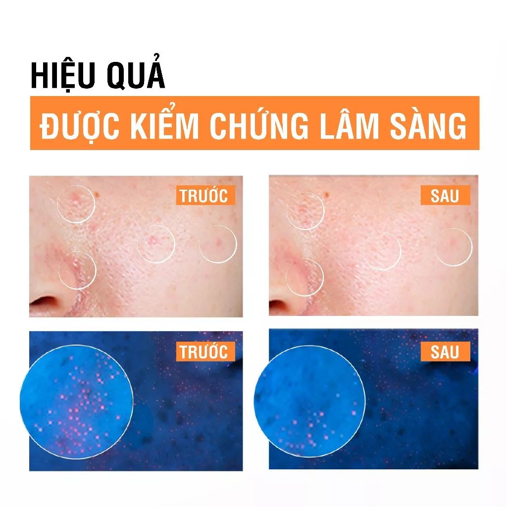 Sữa Rửa Mặt Neutrogena Làm Sạch Sâu Dạng Gel Deep Clean Facial Gel Cleanser 150ml
