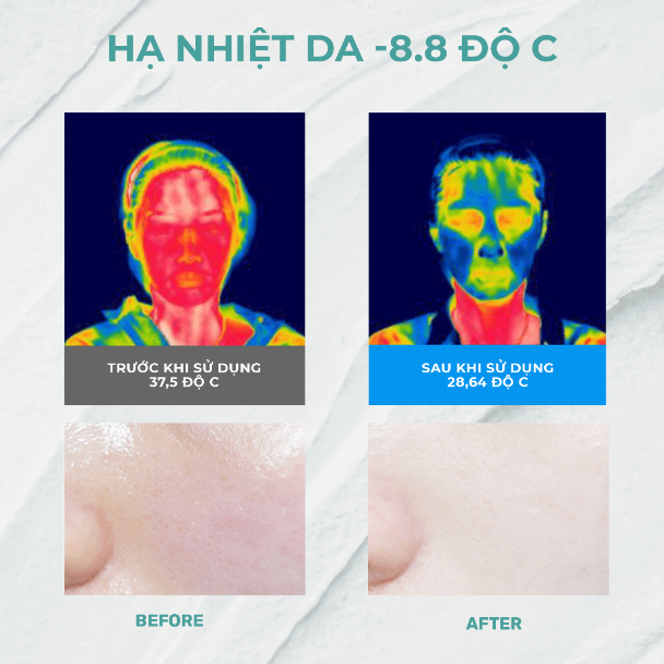 Mặt Nạ Đất Sét Aperire Băng Lạnh Thu Nhỏ Lỗ Chân Lông Và Điều Tiết Dầu Thừa Spa Relief Be Frozen Pore Mask 120g (XANH)