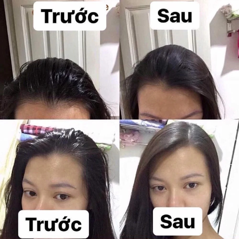 Dầu Gội Khô Batiste Giúp Làm Sạch, Tóc Bồng Bềnh Dry Shampoo 200ml