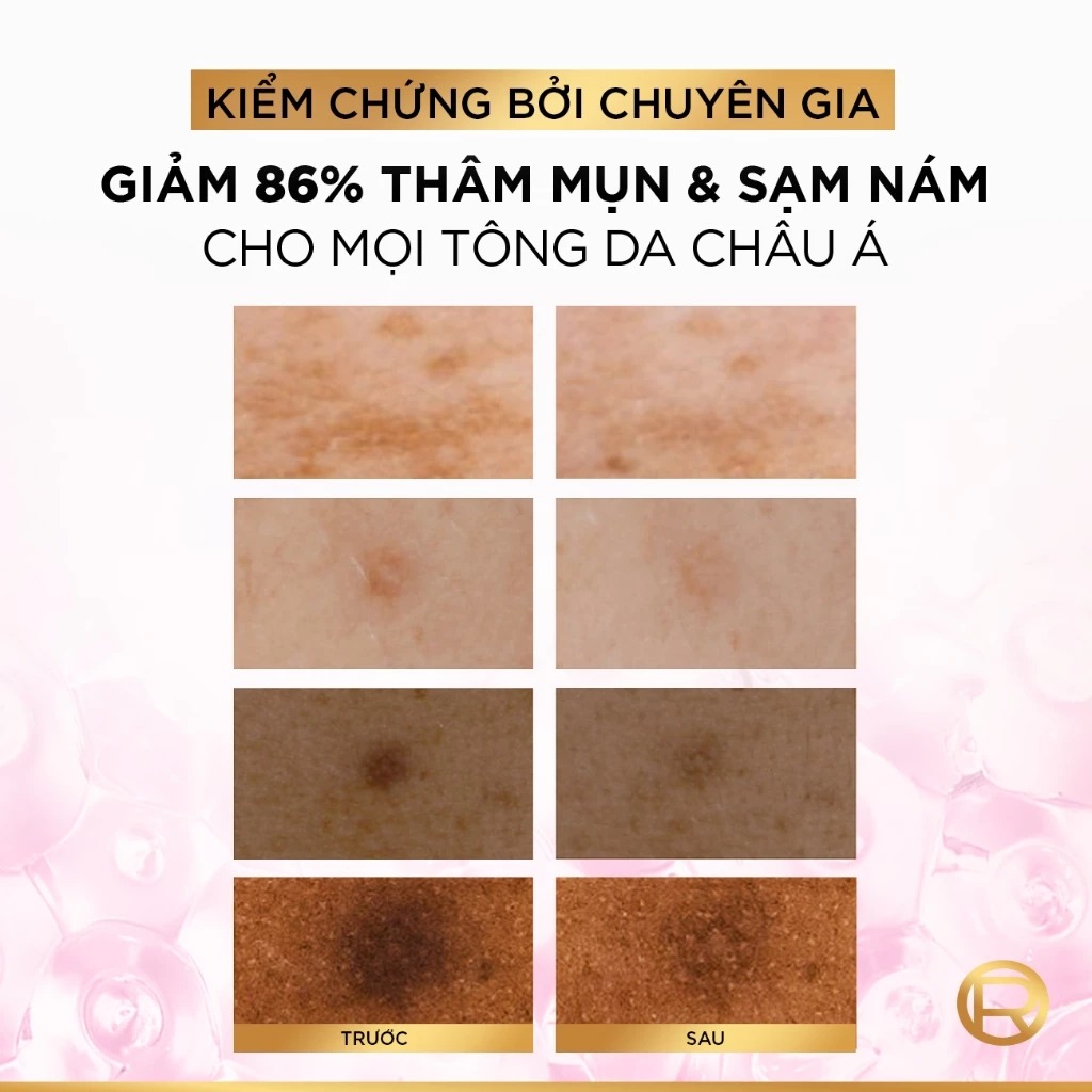 [Mới] Serum L'oreal Tinh Chất Mờ Thâm Nám Glycolic-Bright Melasyl 8% [Melasyl+Glycolic+Niacinamide]