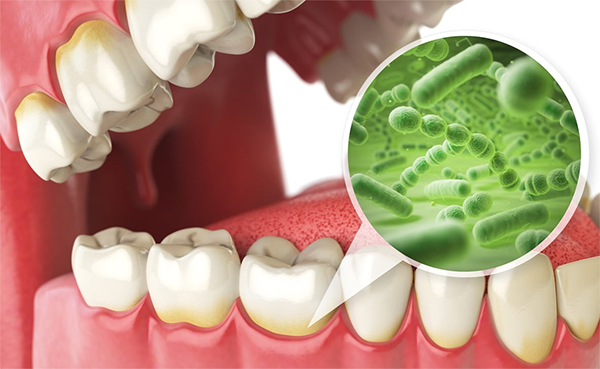 Trong miệng chúng ta có chứa vô vàn các loại vi khuẩn khác nhau