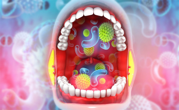 Trong khoang miệng có cả vi khuẩn tốt và vi khuẩn gây hại