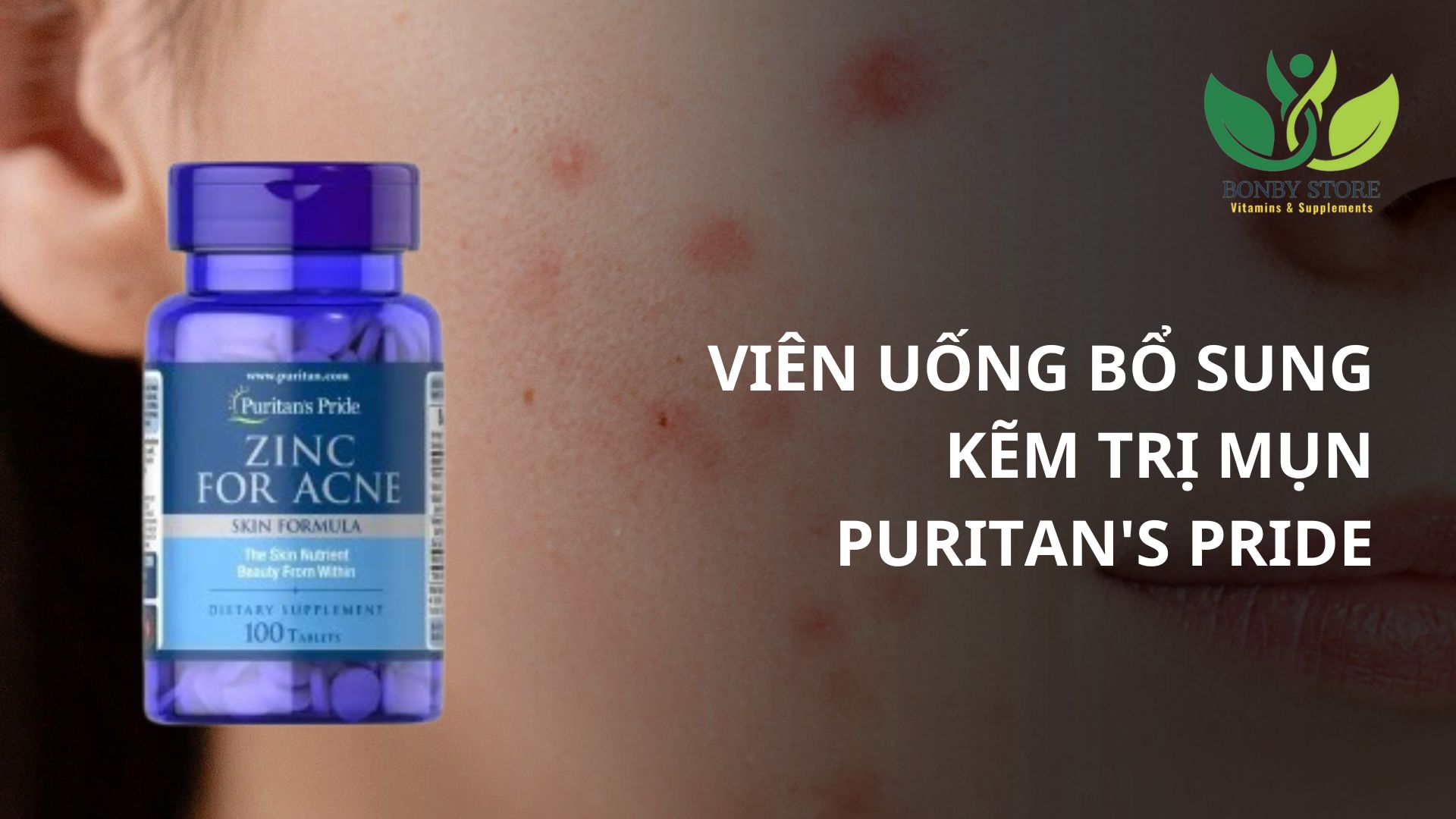 VIÊN UỐNG BỔ SUNG KẼM TRỊ MỤN PURITAN'S PRIDE - CÓ THẬT SỰ HIỆU QUẢ?
