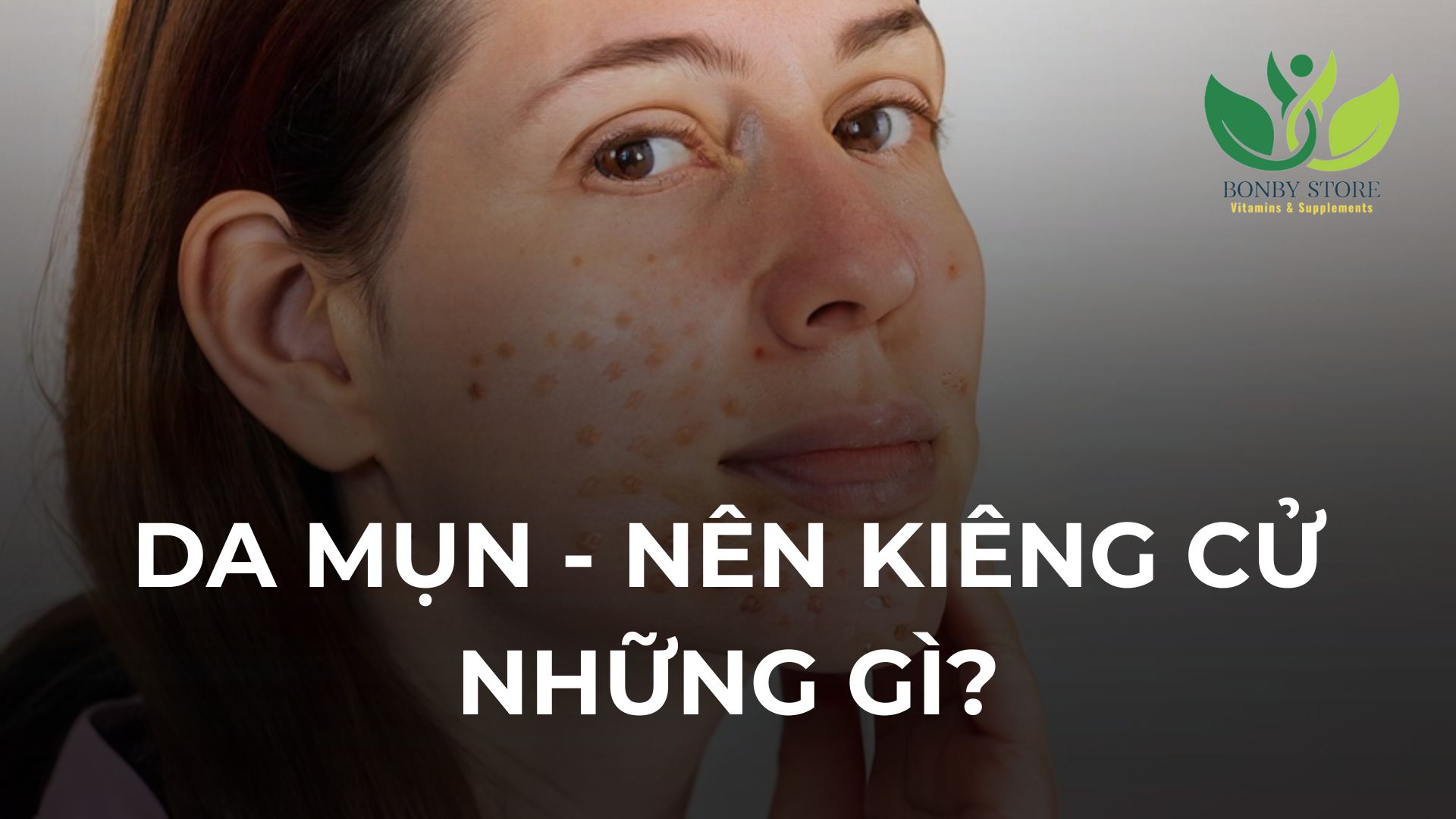 Những Loại Thực Phẩm Cần Kiêng Cữ Khi Da Mặt Có Nhiều Mụn: Hiểu Đúng Để Ngăn Ngừa Từ Gốc