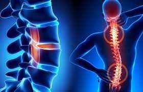 Bí quyết giảm đau và cải thiện chất lượng cuộc sống cho người bị bệnh xương khớp
