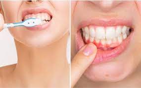 10 cách đơn giản để bảo vệ răng miệng mỗi ngày
