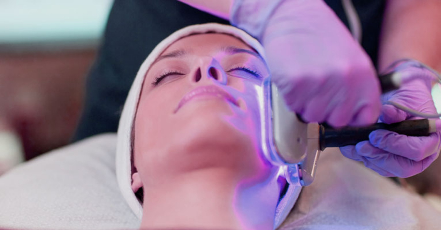trị mụn bằng ánh sáng và laser