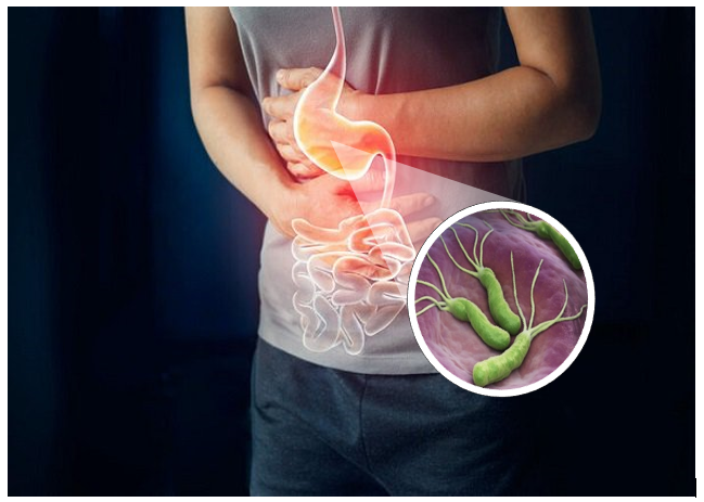 VI KHUẨN HP LÀ GÌ? CÓ LÂY KHÔNG?