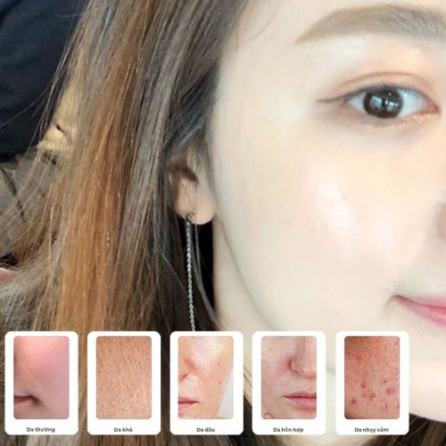 BẠN CÓ BIẾT LOẠI DA CỦA MÌNH KHÔNG?