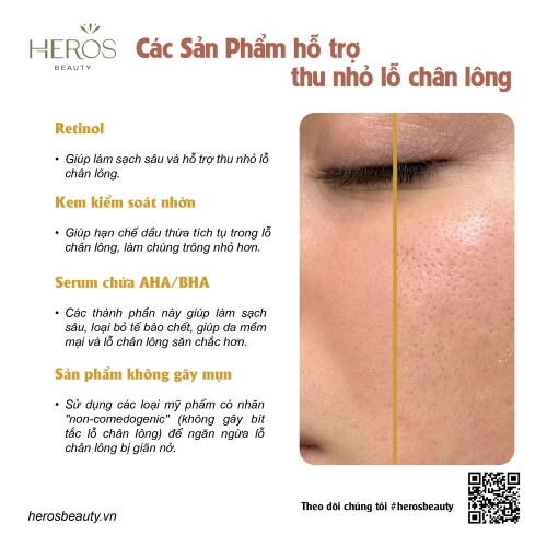 Các sản phẩm hỗ trợ thu nhỏ lỗ chân lông