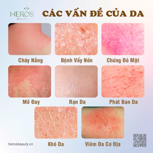 CÁC VẤN ĐỀ THƯỜNG GẶP Ở DA