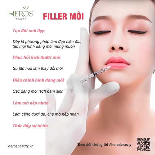 Tiêm filler môi - Giải pháp giúp đôi môi căng mọng, đẹp tự nhiên