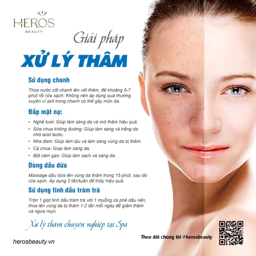 Giải pháp xử lý thâm da đơn giản, nhanh chóng và hiệu quả