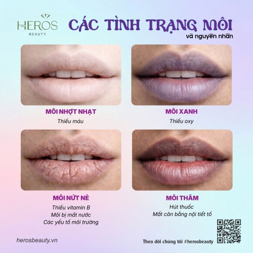 Màu sắc và tình trạng đôi môi cho bạn biết nhiều điều và cách để khắc phục