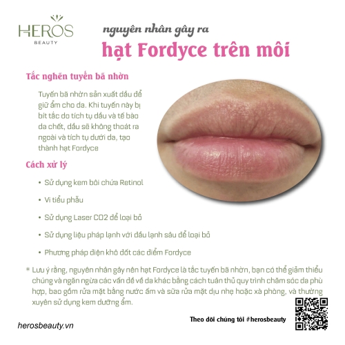 Nguyên nhân gây ra hạt Fordyce trên môi