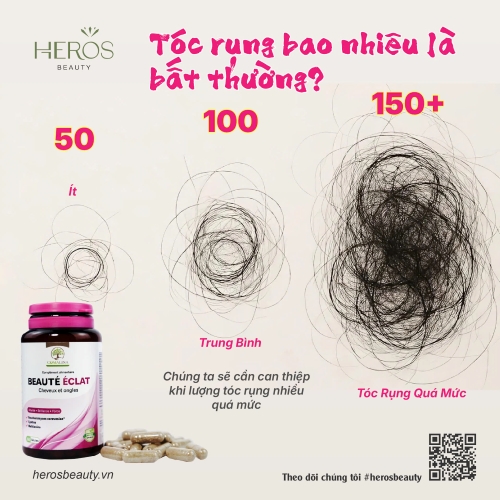 Tóc rụng bao nhiêu là bất thường?