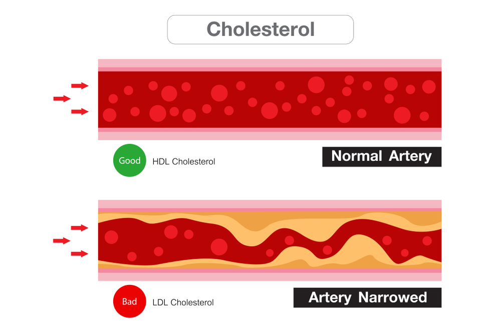Collagen giúp tăng Cholesterol HDL tốt cho tim mạch