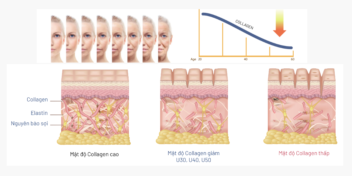 Collagen của da giảm dần theo thời gian