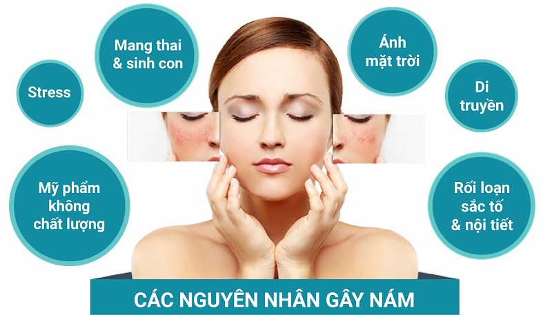 Cách chăm sóc làn da ngăn ngừa, giảm nám và tàn nhang.