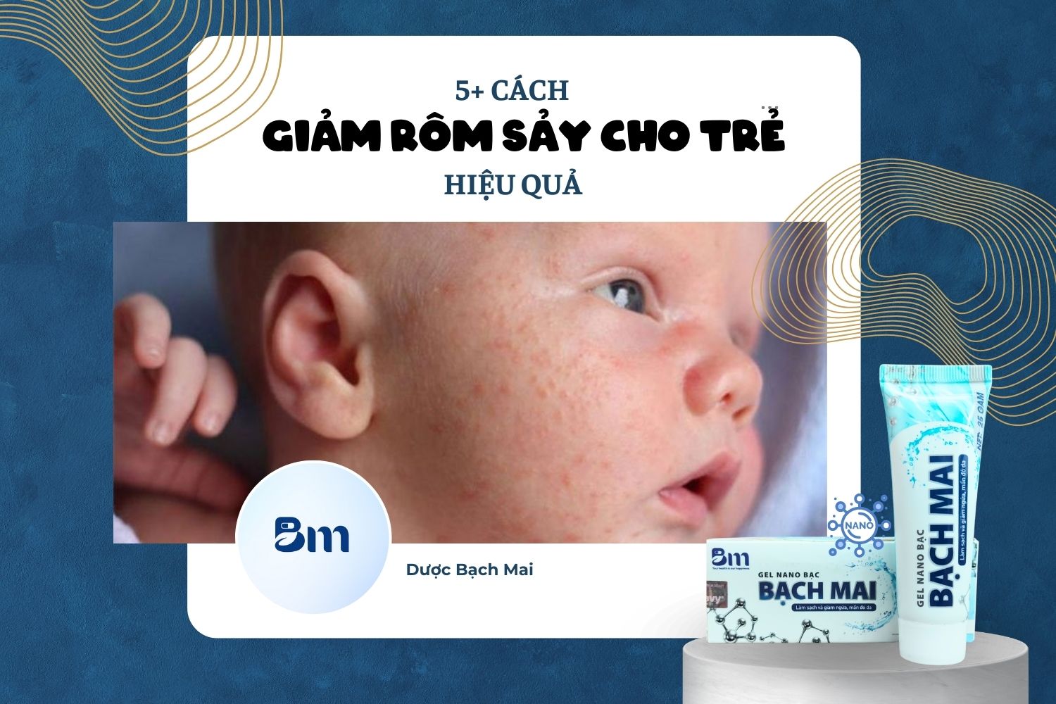Mách mẹ 5+ cách giảm rôm sảy ở trẻ cực hiệu quả ngay tại nhà