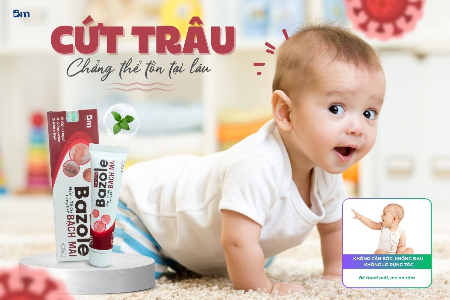 Giảm cứt trâu ở trẻ - Bí quyết đánh bay nhanh gọn cho mẹ yên tâm