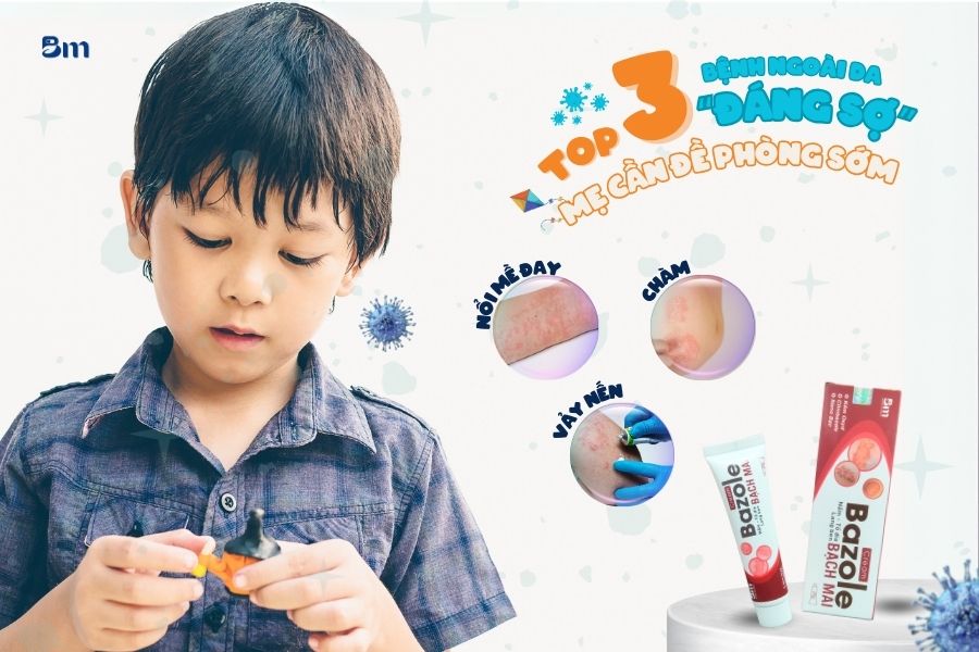 Top 3 bệnh ngoài da mùa đông