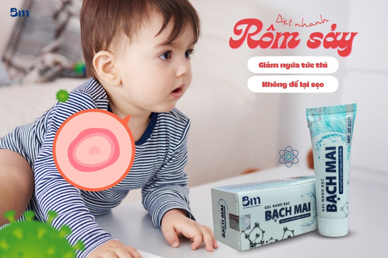 Mách mẹ cách giảm rôm sảy cho bé ăn toàn ngay tại nhà