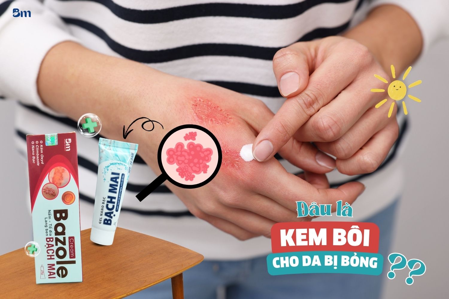 Kem bôi cho da bị bỏng: Chọn đúng loại, da nhanh lành không lo sẹo