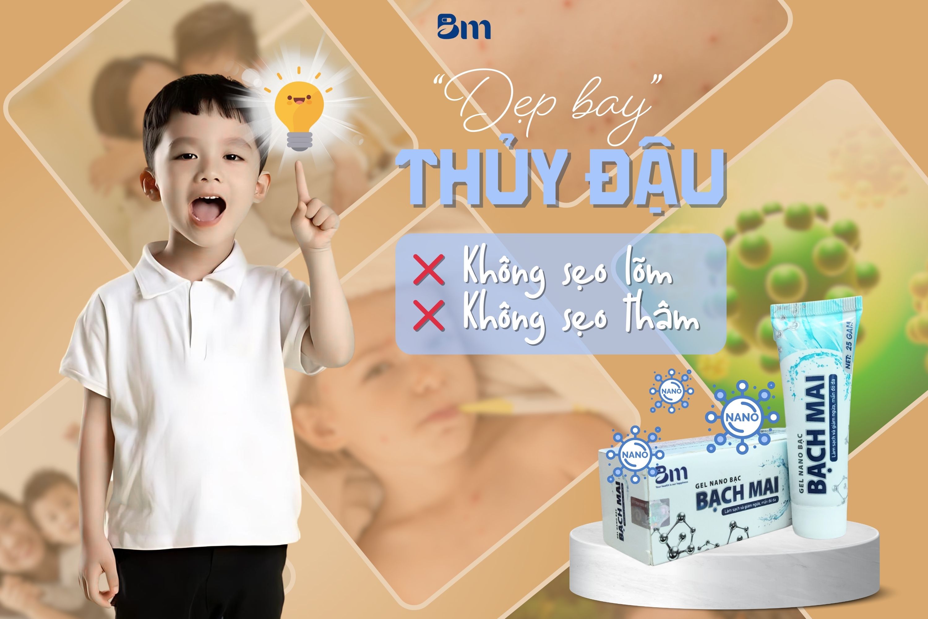 Chữa bệnh thủy đậu ở trẻ em: Giúp trẻ nhanh khỏi và không để lại sẹo