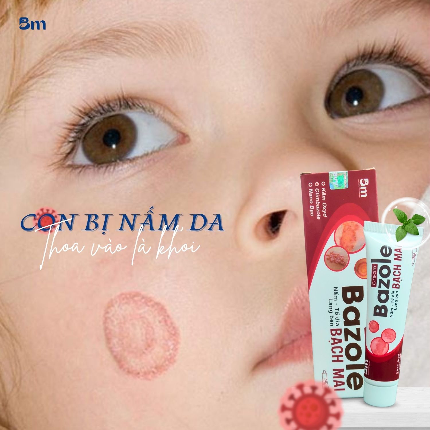 kem bôi giảm cứt trâu ở trẻ là một lựa chọn đáng cân nhắc