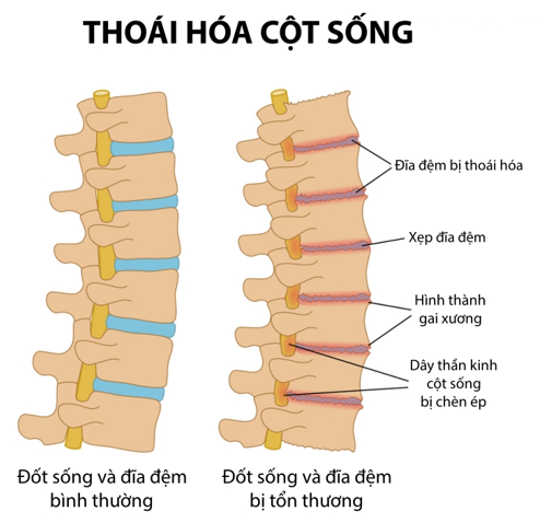 dau-lung-trai-6