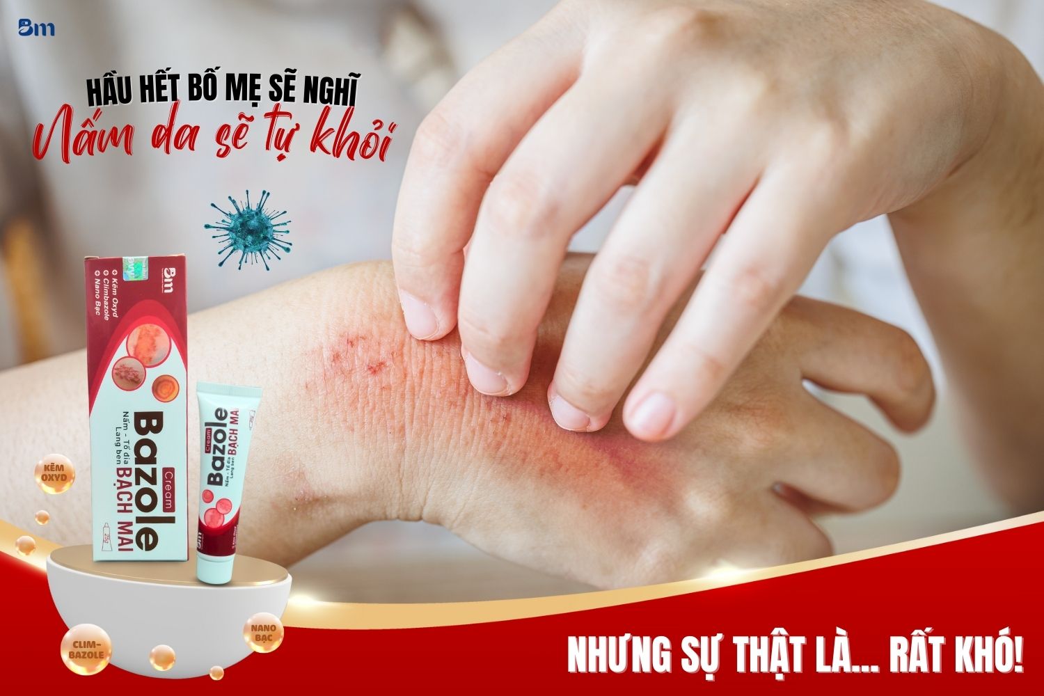 Liệu nấm da có tự hết không, hay cần phải làm gì để giúp con nhanh khỏi bệnh
