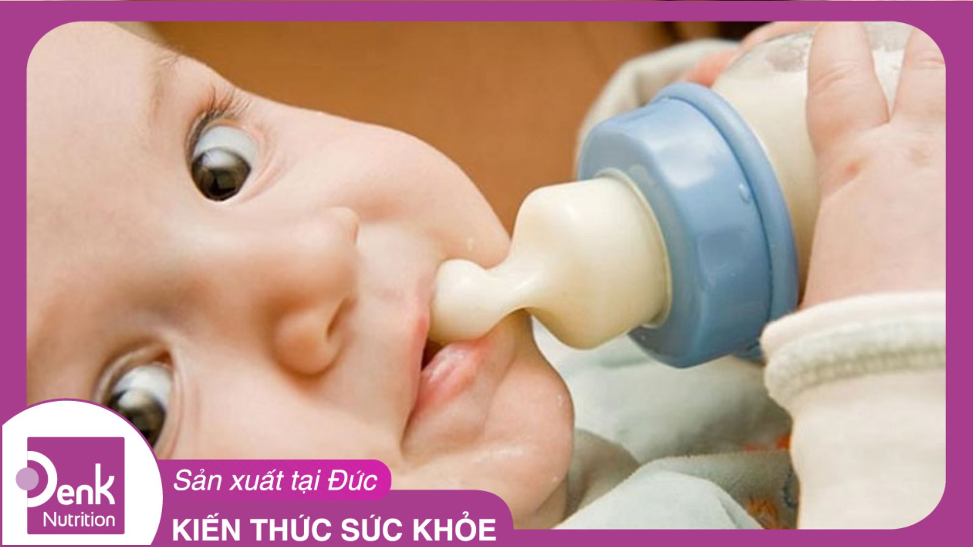 Dấu hiệu nhận biết trẻ bị dị ứng sữa công thức