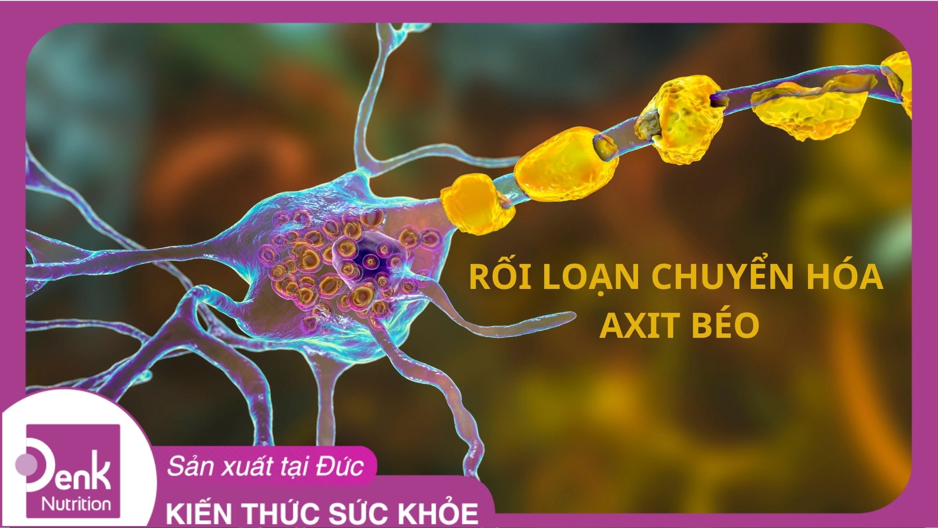 Rối loạn chuyển hóa axit béo