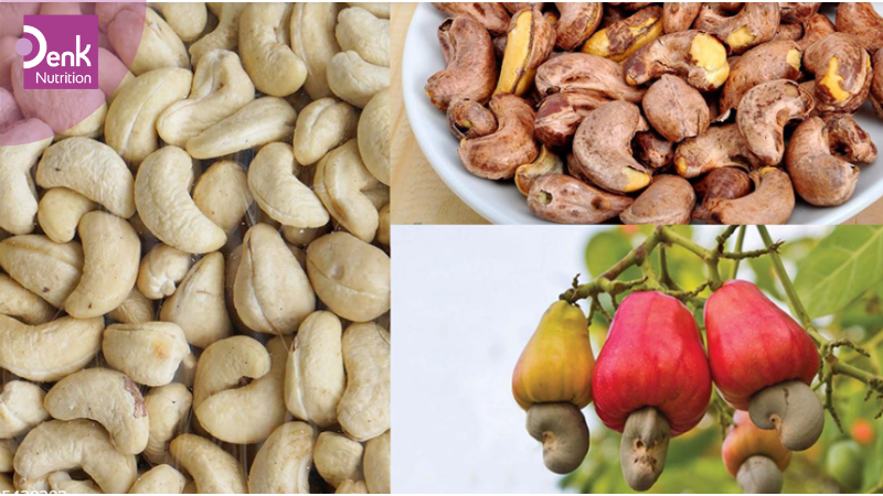 Hạt điều