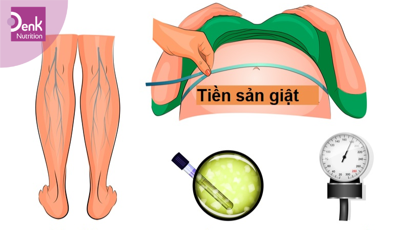 dấu hiệu tiền sản giật 3 tháng cuối 
