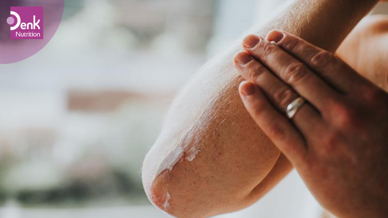 Điều trị bệnh Pellagra
