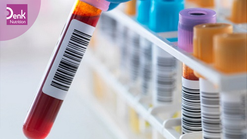 Cách chẩn đoán bé có dị ứng với đạm sữa bò