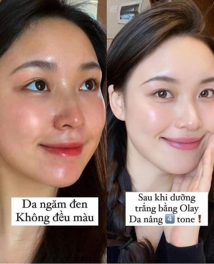 Kem Dưỡng Ban Ngày Olay Total Effects 7 In One Day Moisturiser Nourish & Hydrate 50ml