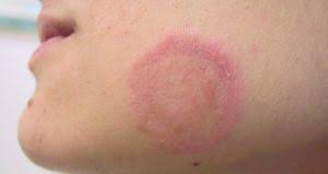Viên Uống Keo Ong Tăng Đề Kháng Propolis NzPureHealth 100 Viên